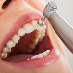 Emergency Dentist Townsville